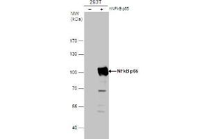 Western Blotting (WB) image for anti-Nuclear Factor-kB p65 (NFkBP65) (Center) antibody (ABIN2855287)