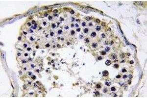 Immunohistochemistry (IHC) analyzes of TRAF6 antibody in paraffin-embedded human testis tissue. (TRAF6 antibody)