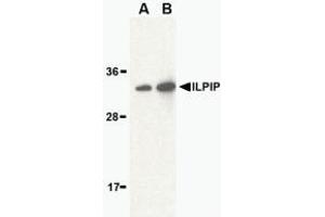 Western blot analysis of ILPIP in human brain lysate with AP30431PU-N ILPIP antibody at (A) 1 and (B) 2 μg/ml. (STRADB antibody  (Intermediate Domain))