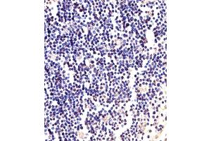 Immunohistochemical analysis of paraffin-embedded H. (ANAPC2 antibody  (C-Term))