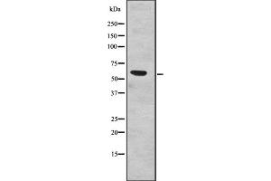 Western blot analysis of SF3A3 expression in Human fetal liver lysates,The lane on the left is treated with the antigen-specific peptide.