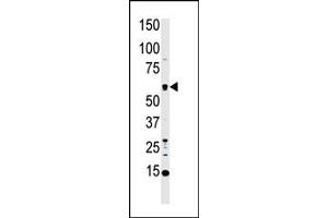 Western blot analysis of anti-MST1 Pab (ABIN392427 and ABIN2842030) in HL60 cell lysate. (MST1 antibody  (C-Term))