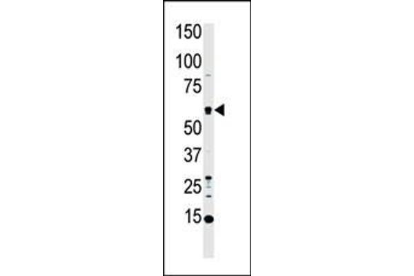 MST1 antibody  (C-Term)