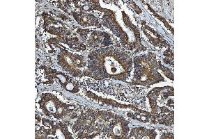 IHC analysis of GPCR RDC1/CXCR-7/ACKR3 using anti-GPCR RDC1/CXCR-7/ACKR3 antibody (ABIN7602889).