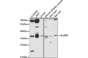 Western blot analysis of extracts of various cell lines, using IL10RB antibody (ABIN7267983) at 1:1000 dilution. (IL10RB antibody  (AA 20-220))