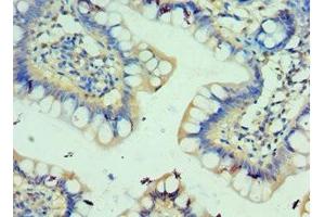 Immunohistochemistry of paraffin-embedded human small intestine tissue using ABIN7146163 at dilution of 1:100 (C3AR1 antibody  (AA 160-340))