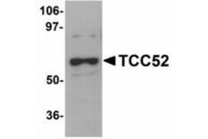 Image no. 1 for anti-DDB1 and CUL4 Associated Factor 12 (DCAF12) (C-Term) antibody (ABIN478276) (DCAF12 antibody  (C-Term))