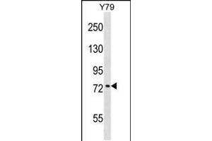 Western blot analysis in Y79 cell line lysates (35ug/lane). (KATNB1 antibody  (AA 331-359))