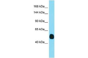 Host: Rabbit  Target Name: Tmprss3  Sample Tissue: Mouse Kidney lysates  Antibody Dilution: 1. (TMPRSS3 antibody  (C-Term))