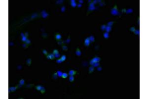 Immunofluorescent analysis of 293T cells using ABIN7162546 at dilution of 1:100 and Alexa Fluor 488-congugated AffiniPure Goat Anti-Rabbit IgG(H+L) (ZDHHC23 antibody  (AA 187-302))