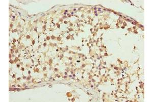 Immunohistochemistry of paraffin-embedded human testis tissue using ABIN7147764 at dilution of 1:100 (WDR16 antibody  (AA 101-400))