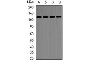 Western blot analysis of Hexokinase 2 expression in SHSY5Y (A), MCF7 (B), K562 (C), COS7 (D) whole cell lysates. (Hexokinase 2 antibody)
