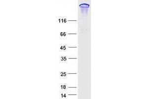 ARHGEF11 Protein (Transcript Variant 2) (Myc-DYKDDDDK Tag)