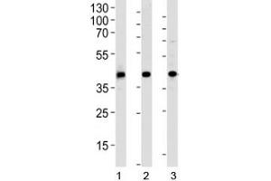 Western blot analysis of 1) human HepG2, 2) mouse kidney and 3) rat spleen tissue lysate using ACADL antibody at 1:1000. (ACADL antibody  (AA 14-43))