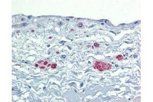 SOX7 antibody was used for immunohistochemistry at a concentration of 4-8 ug/ml. (SOX7 antibody  (Middle Region))