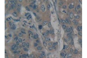 Immunohistochemistry (IHC) image for anti-Myosin, Heavy Polypeptide 10, Non-Muscle (MYH10) (AA 438-716) antibody (ABIN7435520)
