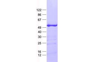 Western Blotting (WB) image for Paired Box 3 (PAX3) protein (His tag) (ABIN2728312)