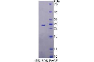Image no. 1 for Trehalase (Brush-Border Membrane Glycoprotein) (TREH) (AA 237-420) protein (His tag) (ABIN6238061)