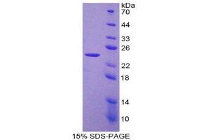 SDS-PAGE (SDS) image for Laminin, beta 2 (Laminin S) (LAMB2) (AA 939-1129) protein (His tag) (ABIN1879744) (LAMB2 Protein (AA 939-1129) (His tag))
