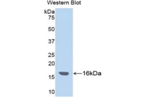 WB of Protein Standard: different control antibodies  against Highly purified E. (ITIH4 ELISA Kit)