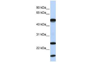 WB Suggested Anti-UBE2L6 Antibody Titration:  0. (UBE2L6 antibody  (N-Term))