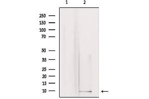 Western blot analysis of extracts from rat brain, using GNG3 Antibody.