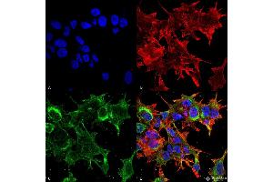 Immunocytochemistry/Immunofluorescence analysis using Mouse Anti-GFAP R416WT Monoclonal Antibody, Clone S206B-9 . (GFAP antibody  (AA 411-422))