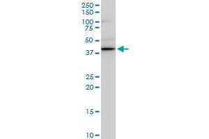 SMARCB1 monoclonal antibody (M03), clone 3C4. (SMARCB1 antibody  (AA 81-180))