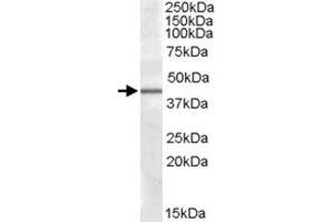 CAMK1D polyclonal antibody  (0. (CAMK1D antibody)