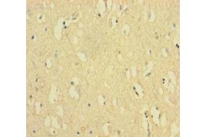 Immunohistochemistry of paraffin-embedded human brain tissue using ABIN7152548 at dilution of 1:100 (FANCD2 antibody  (AA 1-291))