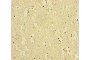 Immunohistochemistry of paraffin-embedded human brain tissue using ABIN7152548 at dilution of 1:100 (FANCD2 antibody  (AA 1-291))