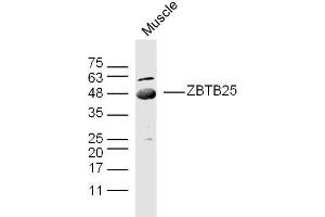 Mouse muscle lysates probed with ZBTB25/ZNF46 Polyclonal Antibody, unconjugated  at 1:300 overnight at 4°C followed by a conjugated secondary antibody at 1:10000 for 90 minutes at 37°C.