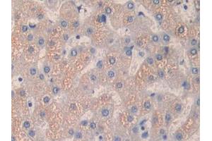 Immunohistochemistry (IHC) image for anti-Quiescin Q6 Sulfhydryl Oxidase 1 (QSOX1) (AA 37-181) antibody (ABIN1860393)