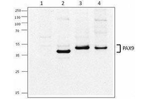 Western Blotting (WB) image for anti-Paired Box 9 (PAX9) antibody (ABIN2665320) (PAX9 antibody)