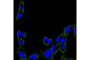 Immunofluorescence analysis of B16 cells using FAK mouse mAb (green). (FAK antibody)