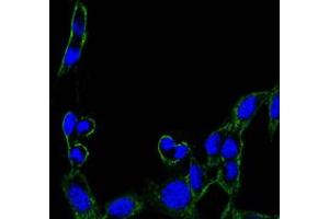Immunofluorescence analysis of B16 cells using FAK mouse mAb (green).