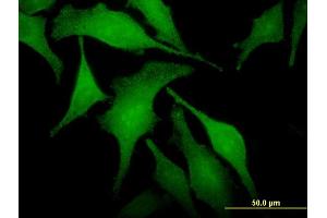 Immunofluorescence of monoclonal antibody to SNX6 on HeLa cell. (SNX6 antibody  (AA 1-290))