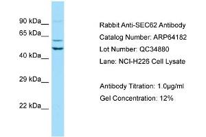 Western Blotting (WB) image for anti-Translocation Protein 1 (TLOC1) (Middle Region) antibody (ABIN2774392) (SEC62 antibody  (Middle Region))