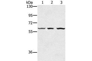 Western Blot analysis of Human breast infiltRative duct tissue, Jurkat and HT-29 cell using OXSR1 Polyclonal Antibody at dilution of 1:300 (OXSR1 antibody)