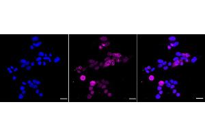 Immunocytochemical staining of HAP-1 cells with MyD88 antibody (ABIN7799510), 1:1,000). (Recombinant MYD88 antibody)
