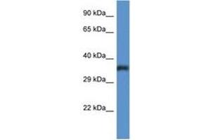 Image no. 1 for anti-Phosphatidylinositol Glycan C (PIGC) (C-Term) antibody (ABIN6746921) (PIGC antibody  (C-Term))