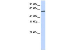 SENP3 antibody used at 1 ug/ml to detect target protein. (SENP3 antibody  (N-Term))