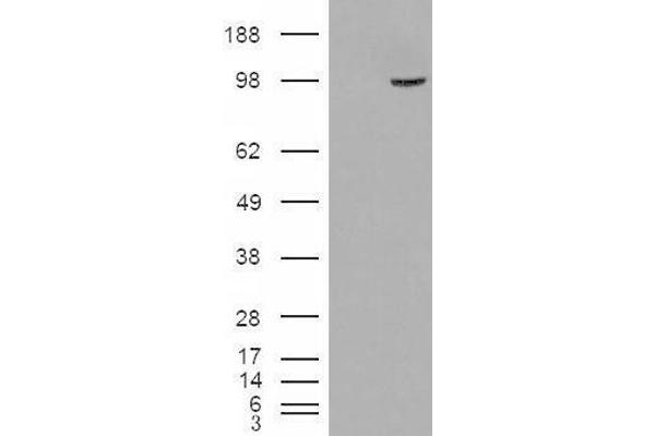 SMEK1 antibody  (Internal Region)