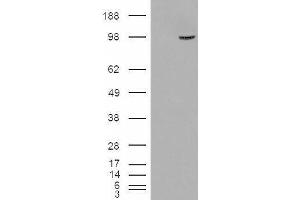 HEK293 overexpressing SMEK1 (ABIN5408171) and probed with ABIN334493 (mock transfection in first lane).