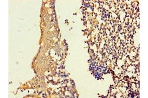 Immunohistochemistry of paraffin-embedded human tonsil tissue using ABIN7155297 at dilution of 1:100 (ASF1B antibody  (AA 1-202))