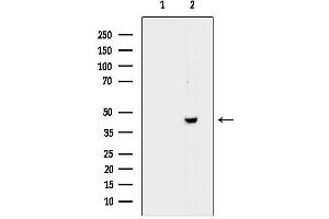 anti-Tachykinin Receptor 2 (TACR2) (C-Term) antibody