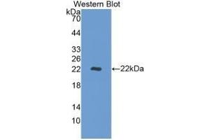 Detection of Recombinant REV1, Human using Monoclonal Antibody to REV1 Homolog (REV1) (REV1 antibody  (AA 301-478))