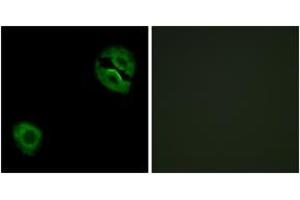 Immunofluorescence analysis of A549 cells, using Collagen XIX alpha1 Antibody.