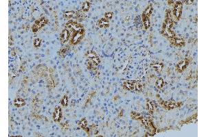 ABIN6272874 at 1/100 staining Mouse kidney tissue by IHC-P. (BBS5 antibody  (C-Term))