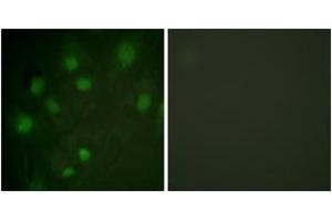 Immunofluorescence analysis of HeLa cells, using IGF2R (Ab-2484) Antibody.